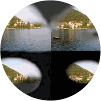 Glaucoma